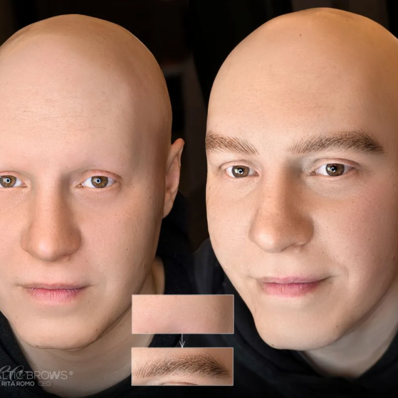 Antakių mikropigmentacija vyrams (plaukeliai aparatu)