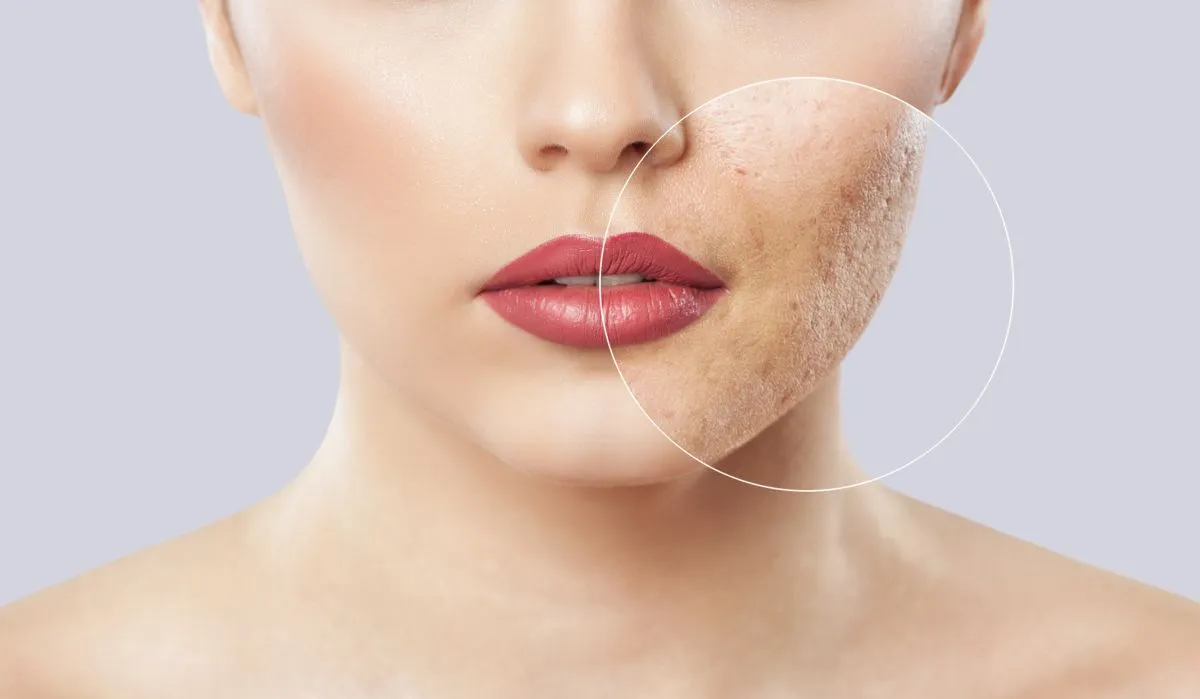 dermatologija
