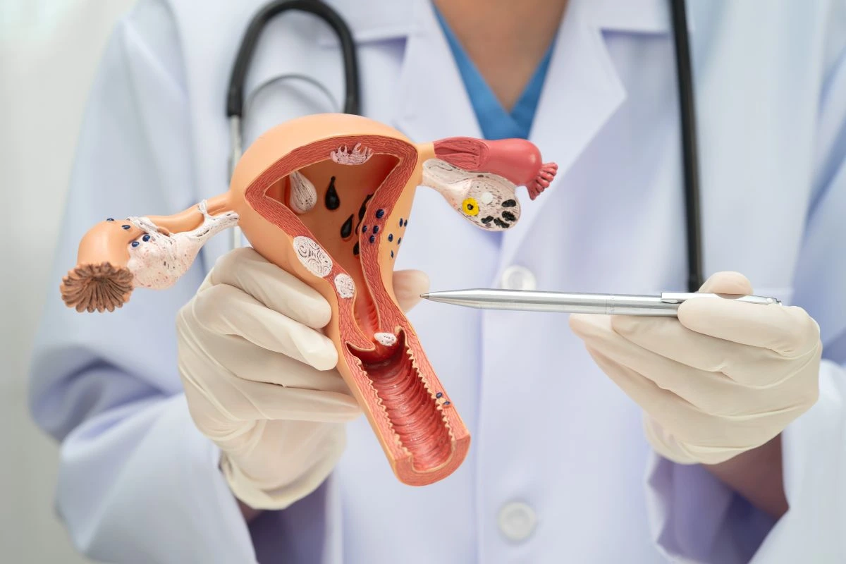 Gimdos_kaklelio_vėžio_gydymas Gimdos kaklelio vėžio gydymas