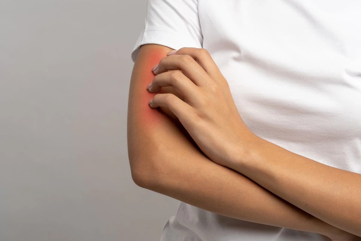 dermatologinės ligos
