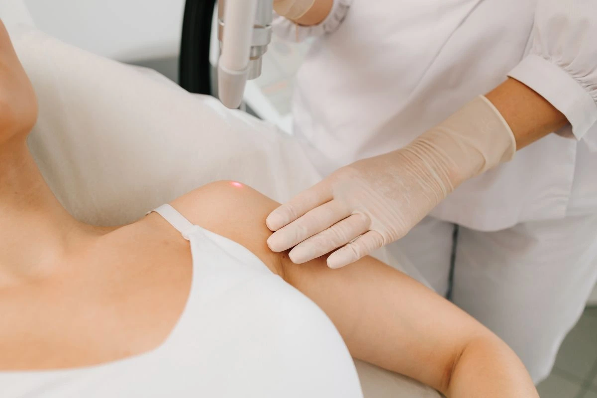 papilomų_šalinimas papilomų šalinimas