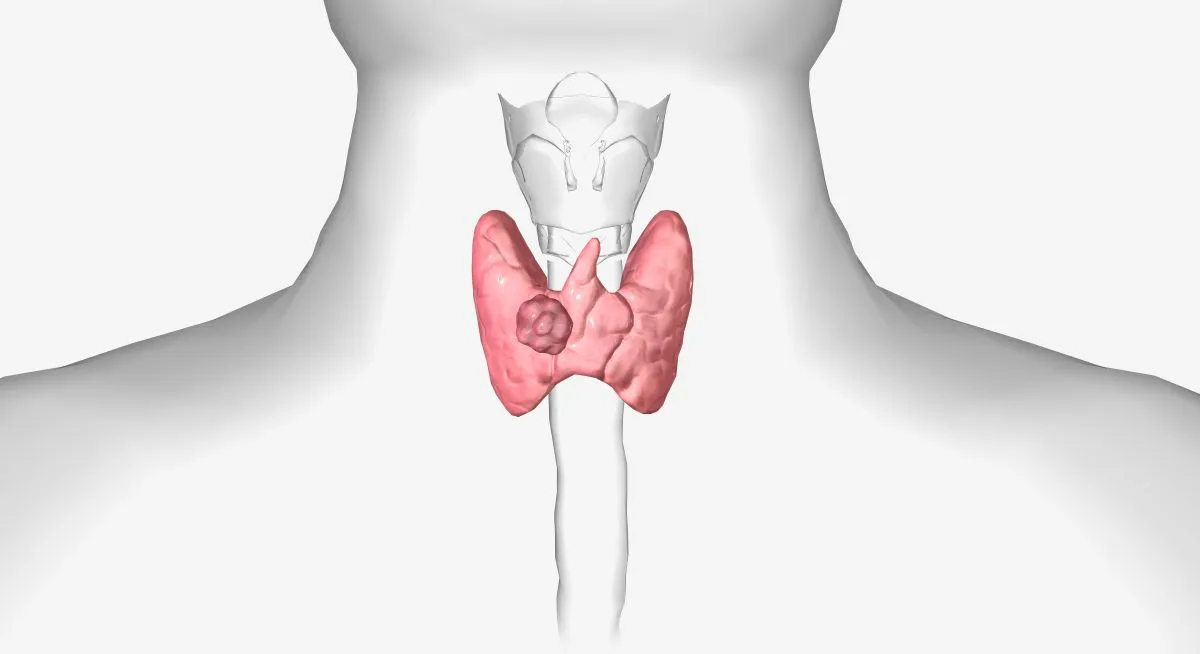 skydliaukės_mazgai skydliaukės mazgai