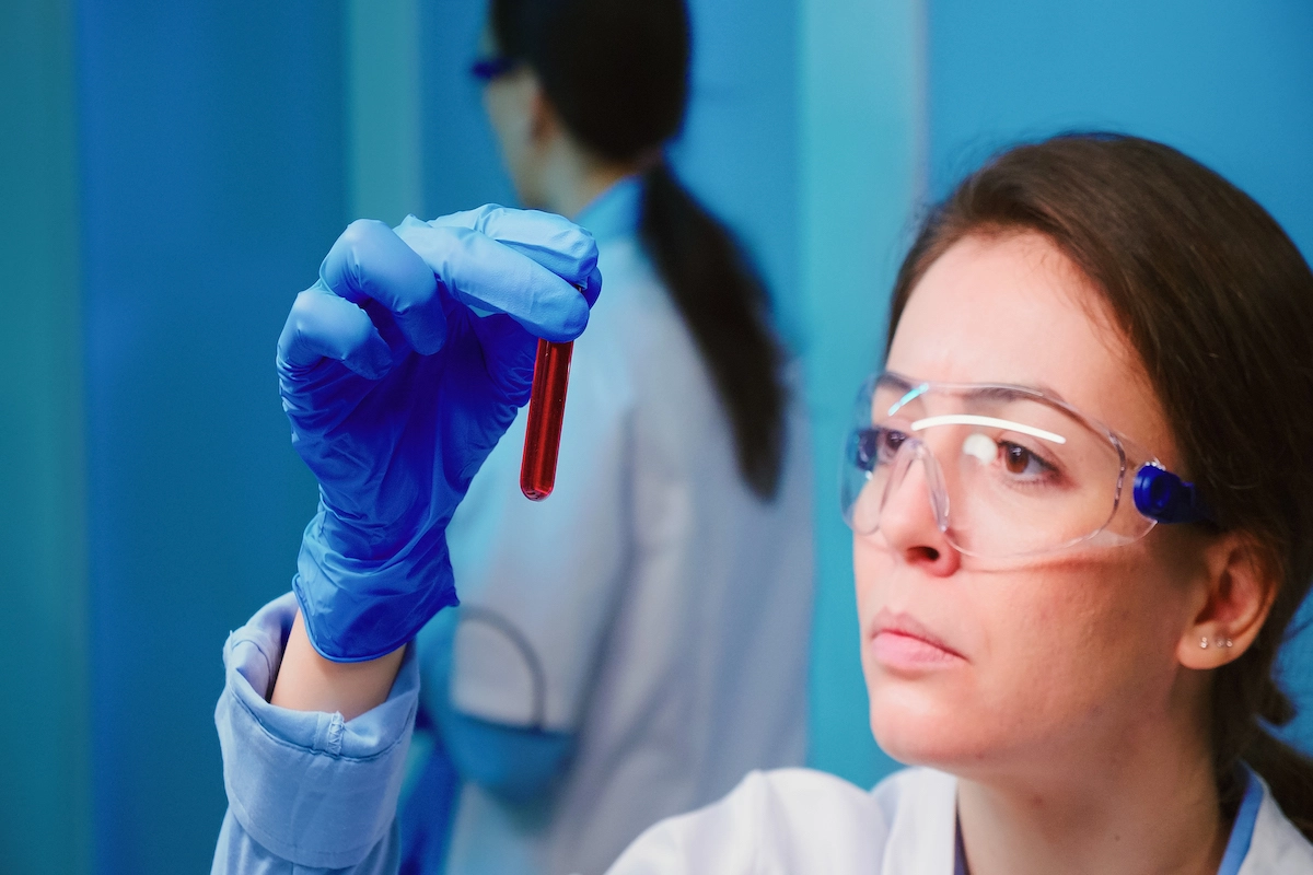 hemolizinės_mažakraujystės_anemijos_gydymas hemolizinės mažakraujystės anemijos gydymas
